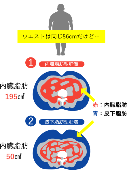 内臓脂肪